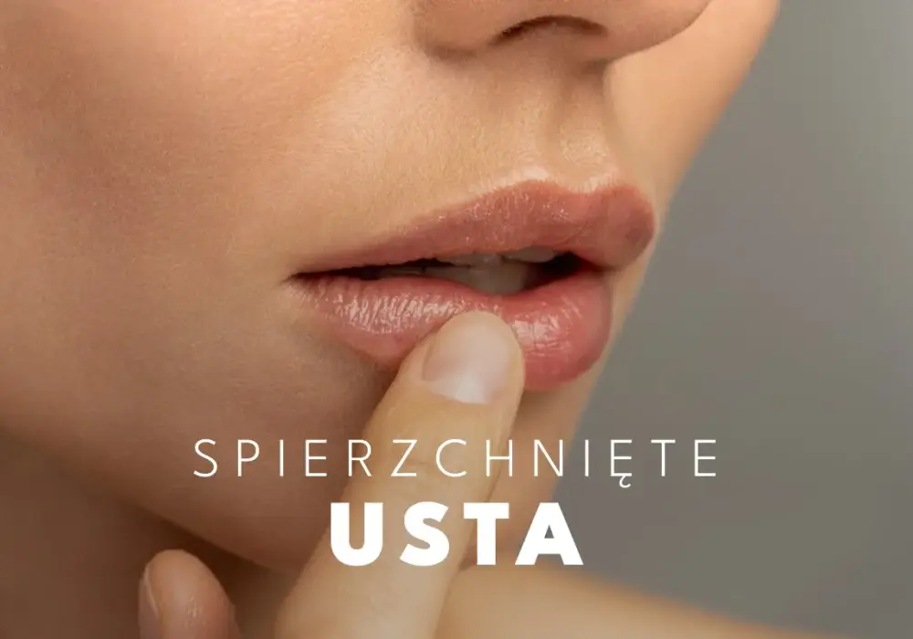 Spierzchnięte usta - przyczyny i pielęgnacja, która działa