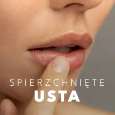 Zbliżenie na usta, które dotyka palec. Tekst: "Spierzchnięte usta". Poznaj suche usta przyczyny.