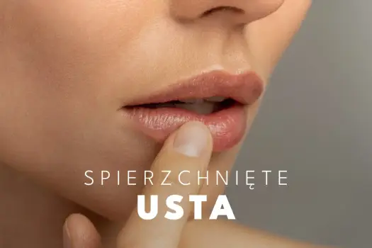 Spierzchnięte usta - przyczyny i pielęgnacja, która działa